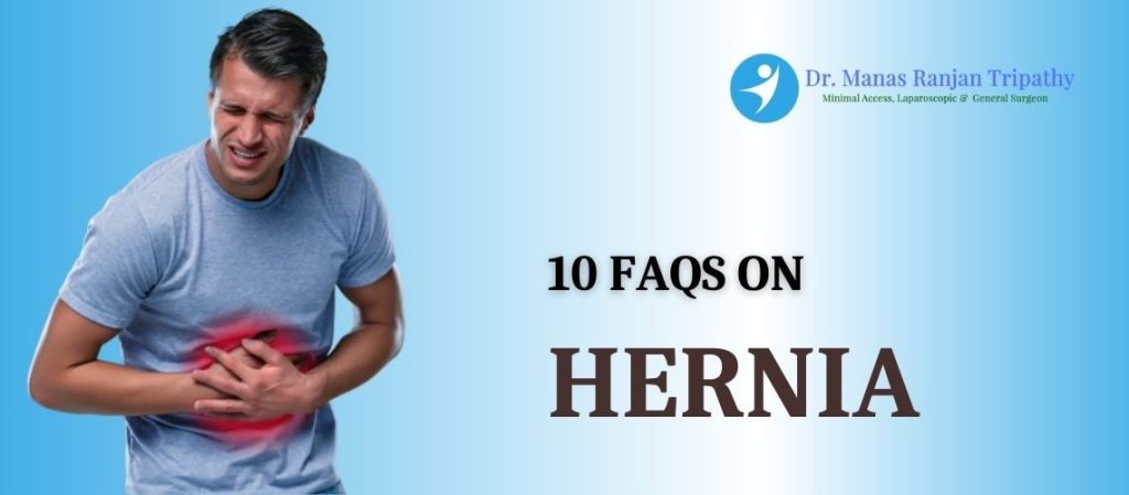 FAQs on Hernia | Best Proctologist in HSR Layout
