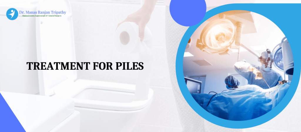Piles Treatment | Piles Doctor in Koramangala