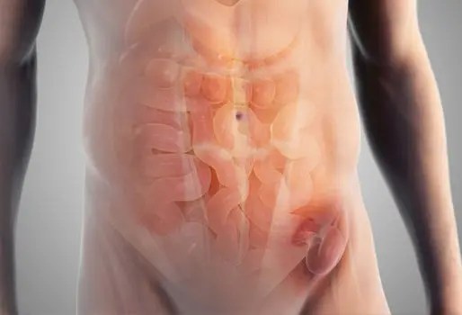 Open Inguinal Hernia Repair in HSR Layout, Bangalore | Dr. Manas Tripathy