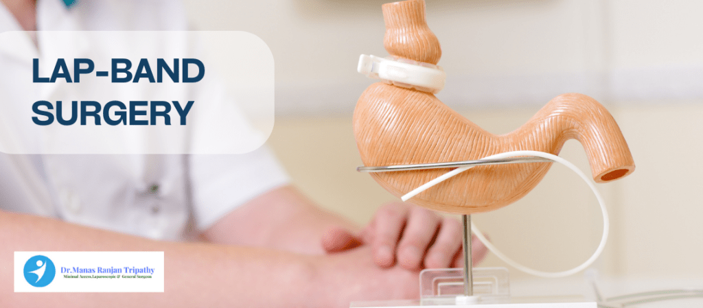 Lap-Band Surgery  Laparoscopic Surgeon in HSR Layout  Dr. Manas Tripathy