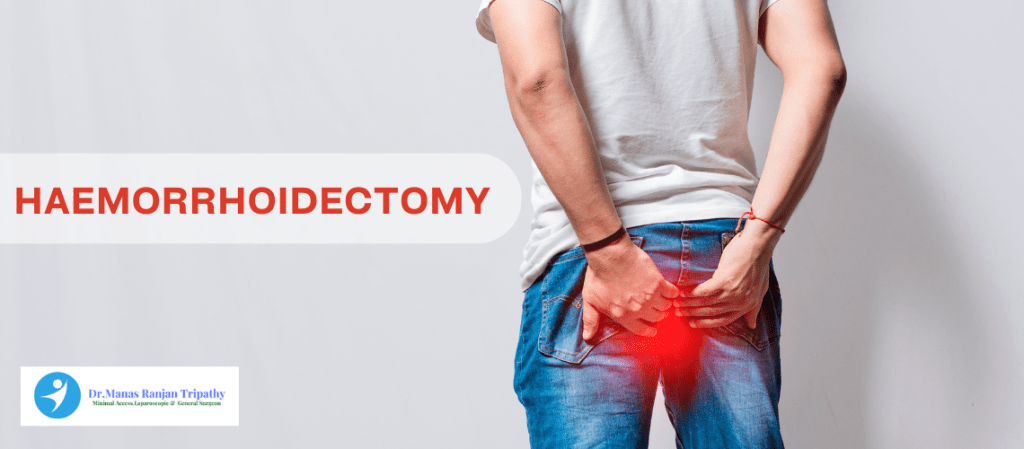Haemorrhoidectomy  Piles Clinic in HSR Layout, Bangalore by Dr. Manas Tripathy